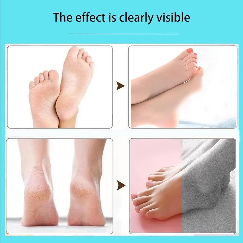 Electric Foot Filer